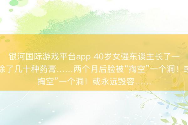 银河国际游戏平台app 40岁女强东谈主长了一颗“痘”，顺手涂了几十种药膏……两个月后脸被“掏空”一个洞！或永远毁容……